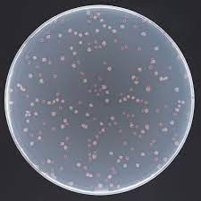 E.coli in a petri dish