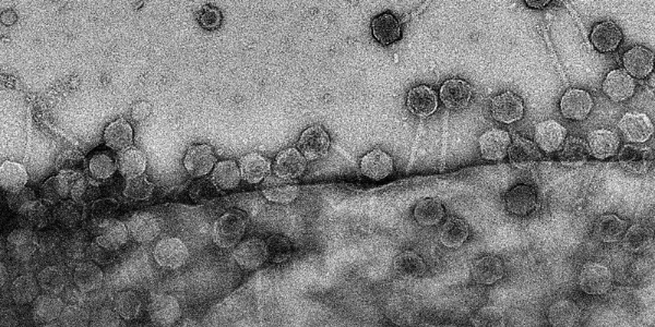 Cryo-EM image of bacteriophages infecting a cell